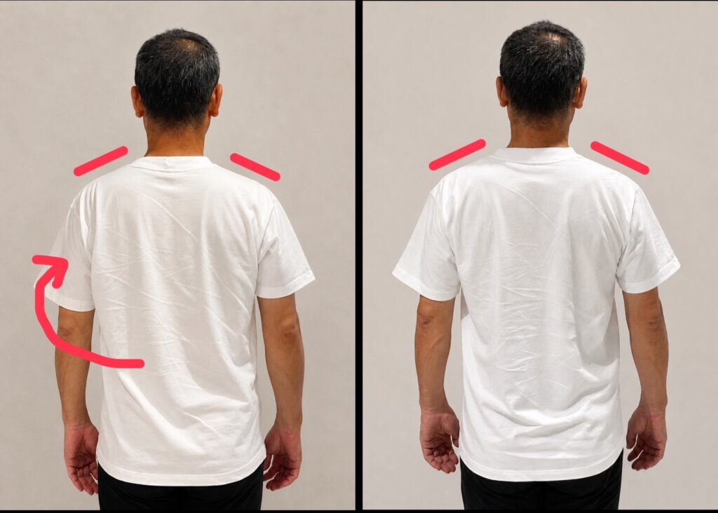 肩の高さの左右差と肩まわりの張りが気になっていた50代男性の事例